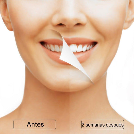 5 Modos Cepillo Dental Eléctrico de Vibración Acústica,con 3 capezas para cambiar