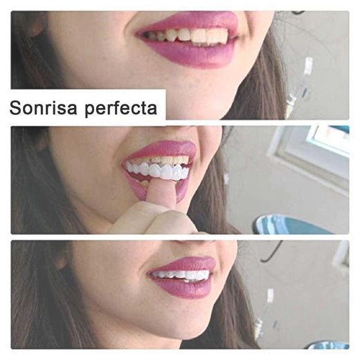 Sonrisa Mágica Dientes Brace
