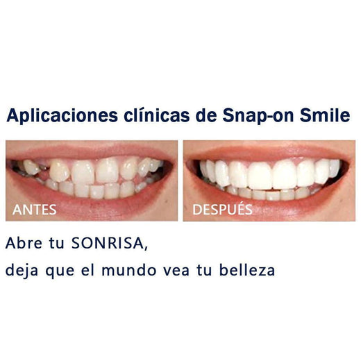 Sonrisa Mágica Dientes Brace