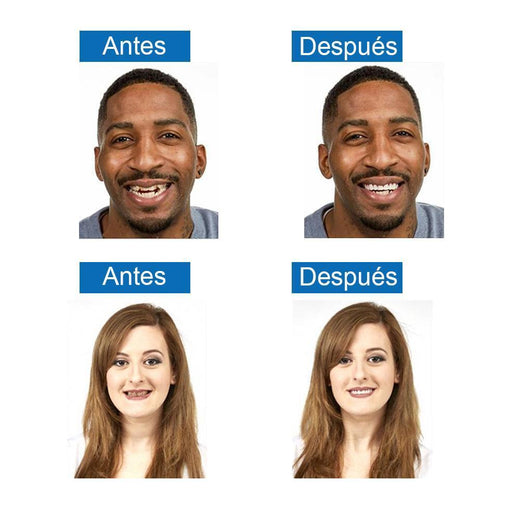 Sonrisa Mágica Dientes Brace