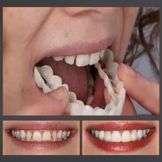Sonrisa Mágica Dientes Brace