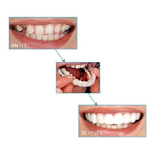 Sonrisa Mágica Dientes Brace